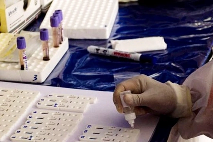 Hasil Rapid Tes Covid-19 di Riau, 14 Orang Positif