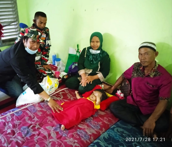 Rumah Singgah Pekanbaru Tampung Bayi Kelainan Cairan Otak
