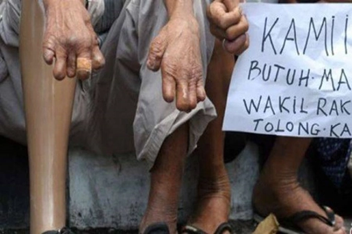 Penyakit Kuno Misterius Hadir Hampir 3.500 Tahun, 'yang belum Bisa Dipecahkan para Ilmuwan'
