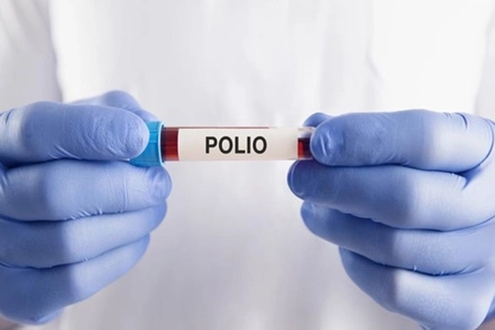 Anak Bisa Lumpuh Layu Akibat Polio, Apa Gejalanya dan Bagaimana Mengatasinya?