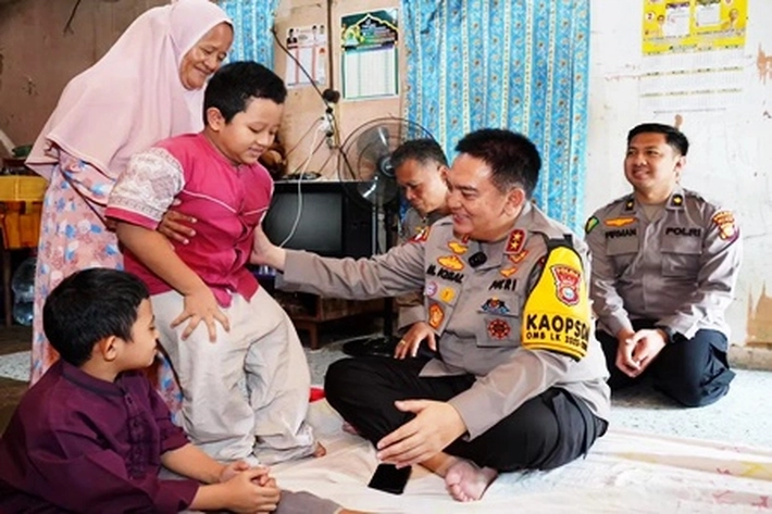 Kapolda Riau Irjen Pol Mohammad Iqbal Datangi Sekaligus Bantu Penderita Tulang Kaca yang Kini Berangsur Pulih