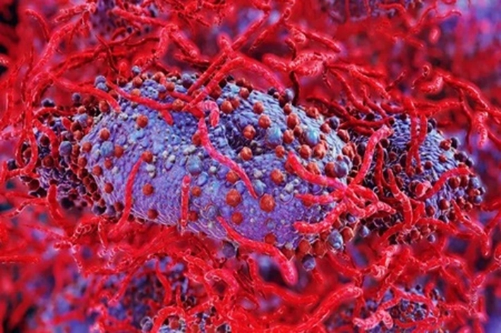 Virus Mpox Bermutasi Bentuk Strain yang Menyebar di Seluruh Dunia