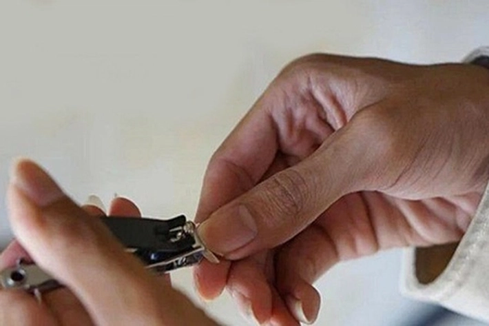 Potong Kuku dan Rambut Dilarang Bagi Mereka yang Berkurban