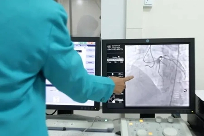 Kaum Muda Makin Banyak Kena Serangan Jantung, Apa Saja Penyebabnya?